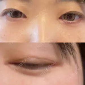 TCB東京中央美容外科 TCB東京中央美容外科 高崎院口コミ