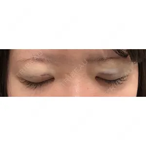 R Beauty CLINIC R Beauty CLINIC 大阪院口コミ