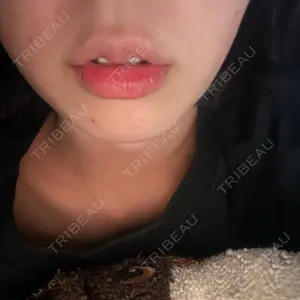 フィラークリニック フィラークリニック 大阪心斎橋院口コミ