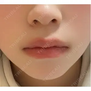 ルラ美容クリニック ルラ美容クリニック 宇都宮院口コミ