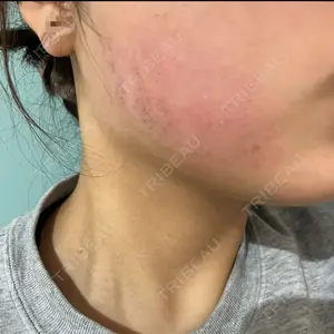 AURORA CLINIC（オーロラクリニック）新宿院口コミ