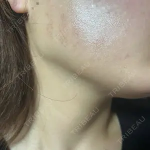 AURORA CLINIC（オーロラクリニック）新宿院口コミ