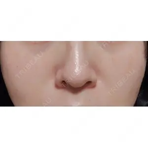 ルラ美容クリニック ルラ美容クリニック 宇都宮院口コミ