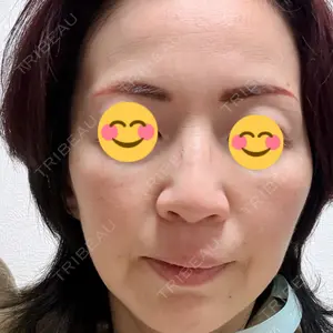 美容皮膚科ティファクリニック 美容皮膚科ティファクリニック 新宿東口口コミ