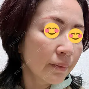 美容皮膚科ティファクリニック 美容皮膚科ティファクリニック 新宿東口口コミ