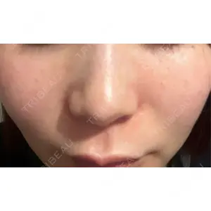 CZEN CLINIC 銀座院口コミ