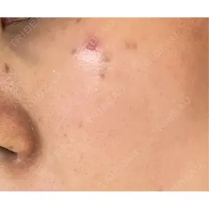 APスキンクリニック銀座口コミ