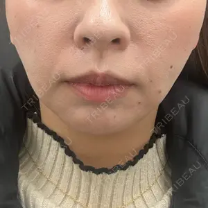 BLINC CLINIC （ブリンク クリニック）口コミ