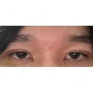 東京イセアクリニック口コミ
