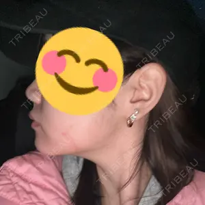 東京美容皮膚科アロエクリニック 東京美容皮膚科アロエクリニック池袋口コミ