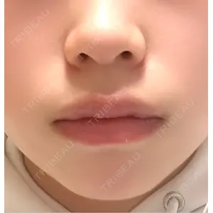 ルラ美容クリニック ルラ美容クリニック 宇都宮院口コミ