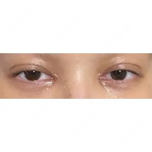 東京シンデレラ美容外科 東京シンデレラ美容外科 池袋院口コミ