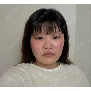 Nebula Clinic 新宿美容外科ネビュラクリニック口コミ