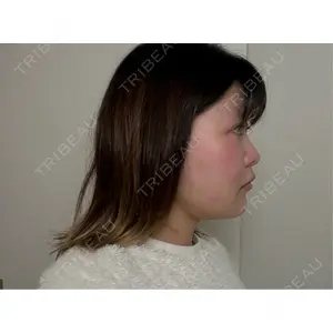 Nebula Clinic 新宿美容外科ネビュラクリニック口コミ