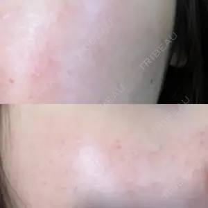 東京美容皮膚科アロエクリニック 東京美容皮膚科アロエクリニック池袋口コミ