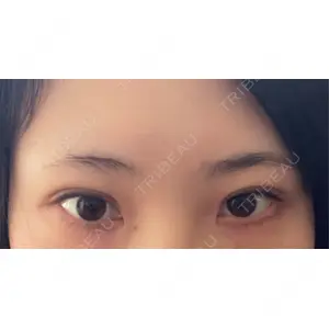 東京イセアクリニック口コミ