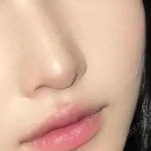 ASTRA BEAUTY CLINIC口コミ