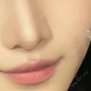 ASTRA BEAUTY CLINIC口コミ