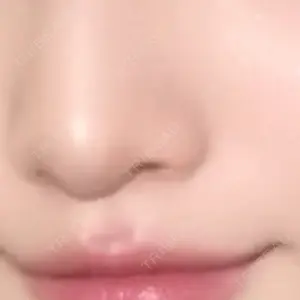 ASTRA BEAUTY CLINIC口コミ