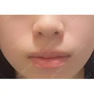 ルラ美容クリニック ルラ美容クリニック 宇都宮院口コミ