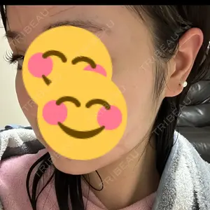 東京美容皮膚科アロエクリニック 東京美容皮膚科アロエクリニック池袋口コミ