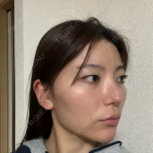 ASTRA BEAUTY CLINIC口コミ