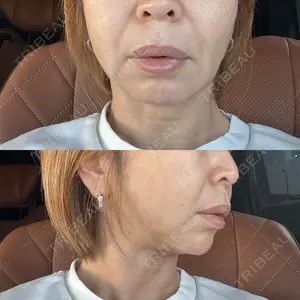 アリエル美容クリニック アリエル美容クリニック 大宮院口コミ