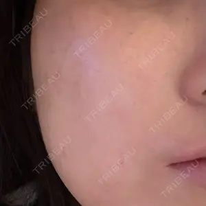 ライズワン美容皮膚科クリニック口コミ