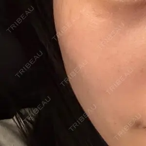 ライズワン美容皮膚科クリニック口コミ