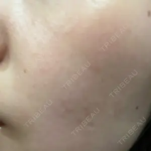 東京美容皮膚科アロエクリニック 東京美容皮膚科アロエクリニック池袋口コミ