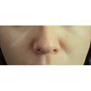 ルラ美容クリニック ルラ美容クリニック 宇都宮院口コミ