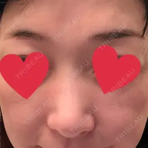 グランジョイクリニック口コミ