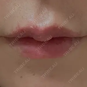 HAAB CLINIC HAAB×DREAM BEAUTY CLINIC 東京本院口コミ