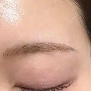 グランジョイクリニック口コミ