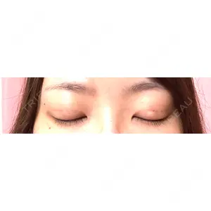 ルラ美容クリニック ルラ美容クリニック 札幌本院口コミ