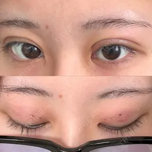 アイビークリニック 吉祥寺アイビークリニック口コミ