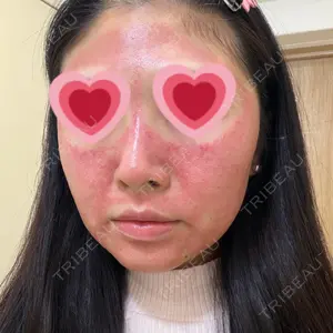 東京美容皮膚科アロエクリニック 東京美容皮膚科アロエクリニック池袋口コミ