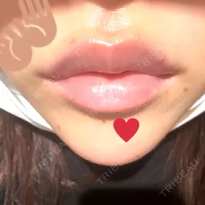 口コミ