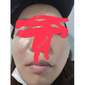 APスキンクリニック銀座口コミ