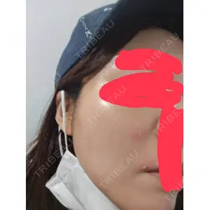 APスキンクリニック銀座口コミ