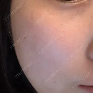 ライズワン美容皮膚科クリニック口コミ