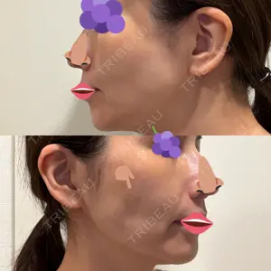 PRISM Beauty Clinic  PRISM Beauty Clinic 新宿院口コミ