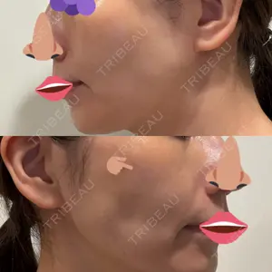 BBC BBC表参道院口コミ