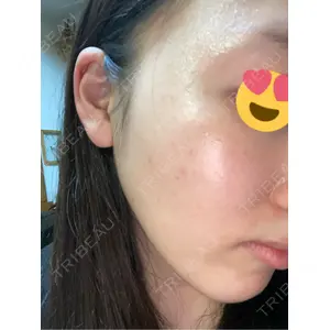 美容皮膚科ティファクリニック 美容皮膚科ティファクリニック 新宿東口口コミ