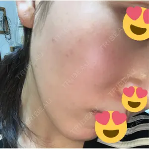 美容皮膚科ティファクリニック 美容皮膚科ティファクリニック 新宿東口口コミ