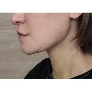 銀座マイアミ美容外科の