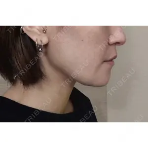 銀座マイアミ美容外科の