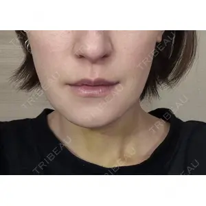 銀座マイアミ美容外科の