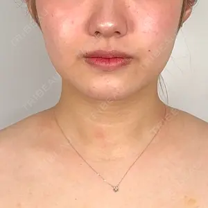 口コミ