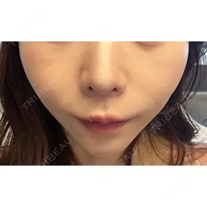 口コミ